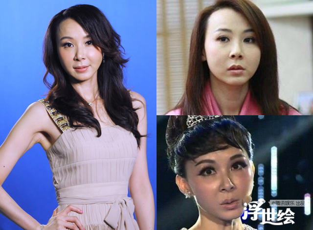 stephanie-hsiao-botox.jpeg